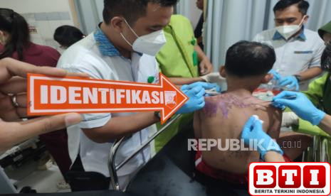 ibu-dan-anak-di-sukabumi-jadi-korban-penyiraman-air-keras-oleh-otk