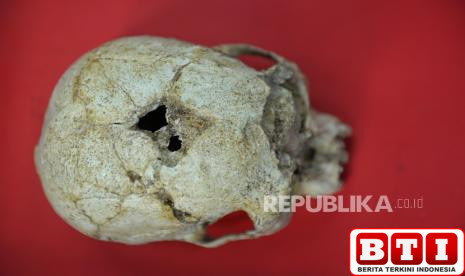 misteri-tengkorak-di-plafon-dapur-polisi-buru-jejak-pemilik-rumah-sebelumnya