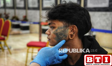 baznas-dki-jakarta-buka-pendaftaran-layanan-hapus-tato-gratis